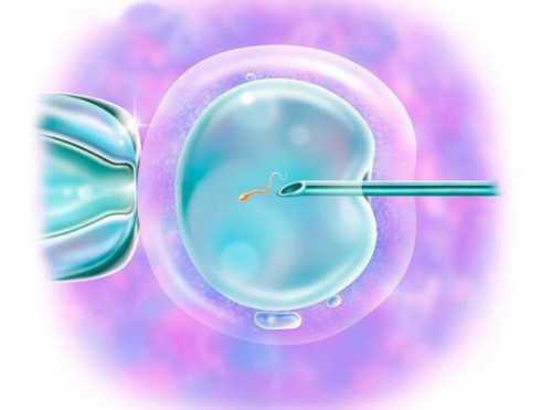 [试管婴儿移植方案]解决不孕不育困境的选择