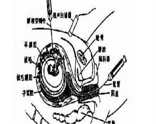 花几分钟带你了解孕酮、HGG跟流产的孕期关系!