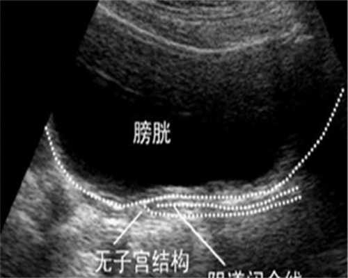 移植后泡脚的好处，试管移植后热水泡脚的3大好处汇总