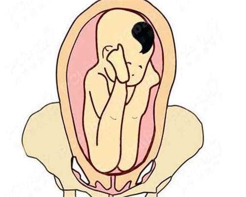 东莞代怀包男宝,东莞供卵国外：东莞供卵试管婴儿