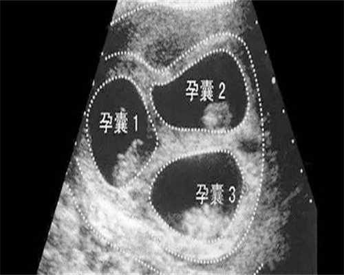广州代生价位是多少,广州代生产子公司在哪里?