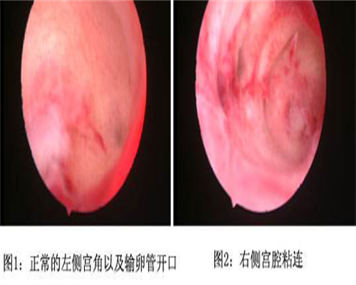 东莞助孕机构排名,东莞供卵流程:东莞供卵试管婴儿