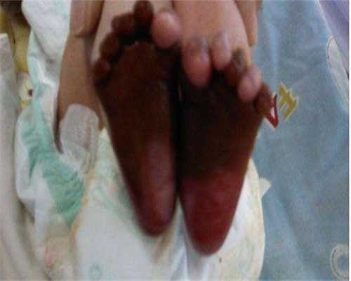 东莞代生服务,东莞供卵国外：东莞供卵试管婴儿