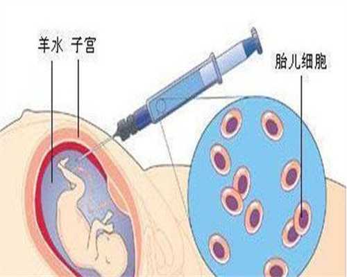 代孕产子服务-剖腹产开几层(剖腹产后护理)