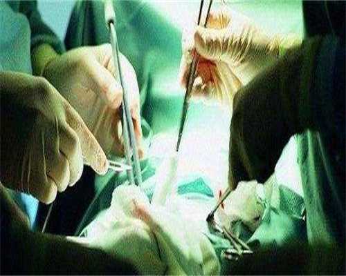 东莞做第三代试管婴儿需要什么条件？高龄做东莞三代试管婴儿要注意什么？